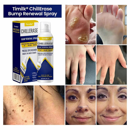 Cooling Bump Renewal Spray - Affordable Skin and Hair Care Products
