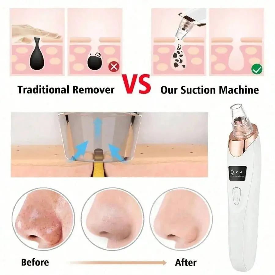 Electric Pore Cleaner & Blackhead Remover - Affordable Skin and Hair Care Products