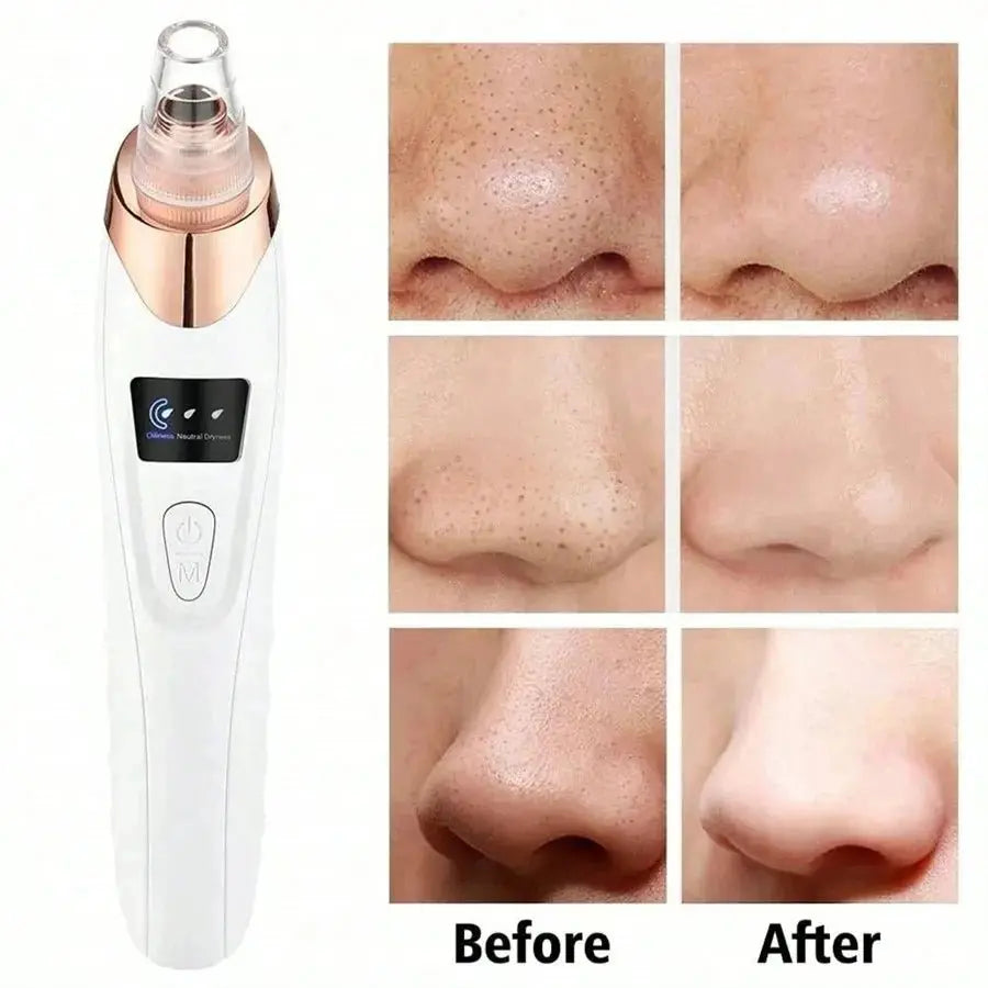 Electric Pore Cleaner & Blackhead Remover - Affordable Skin and Hair Care Products