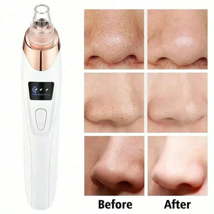 Electric Pore Cleaner & Blackhead Remover - Affordable Skin and Hair Care Products