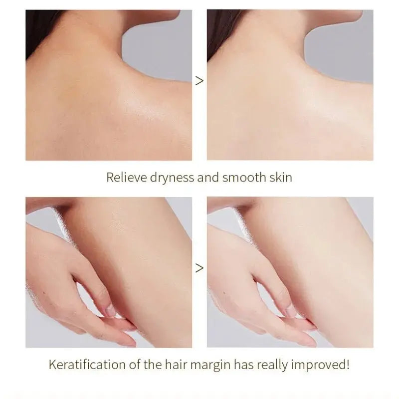Gentle Exfoliating Gel: Orange Deep Pore Cleansing Scrub - Affordable Skin and Hair Care Products